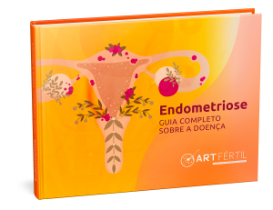 Endometriose Guia completo sobre a doença Art Fértil