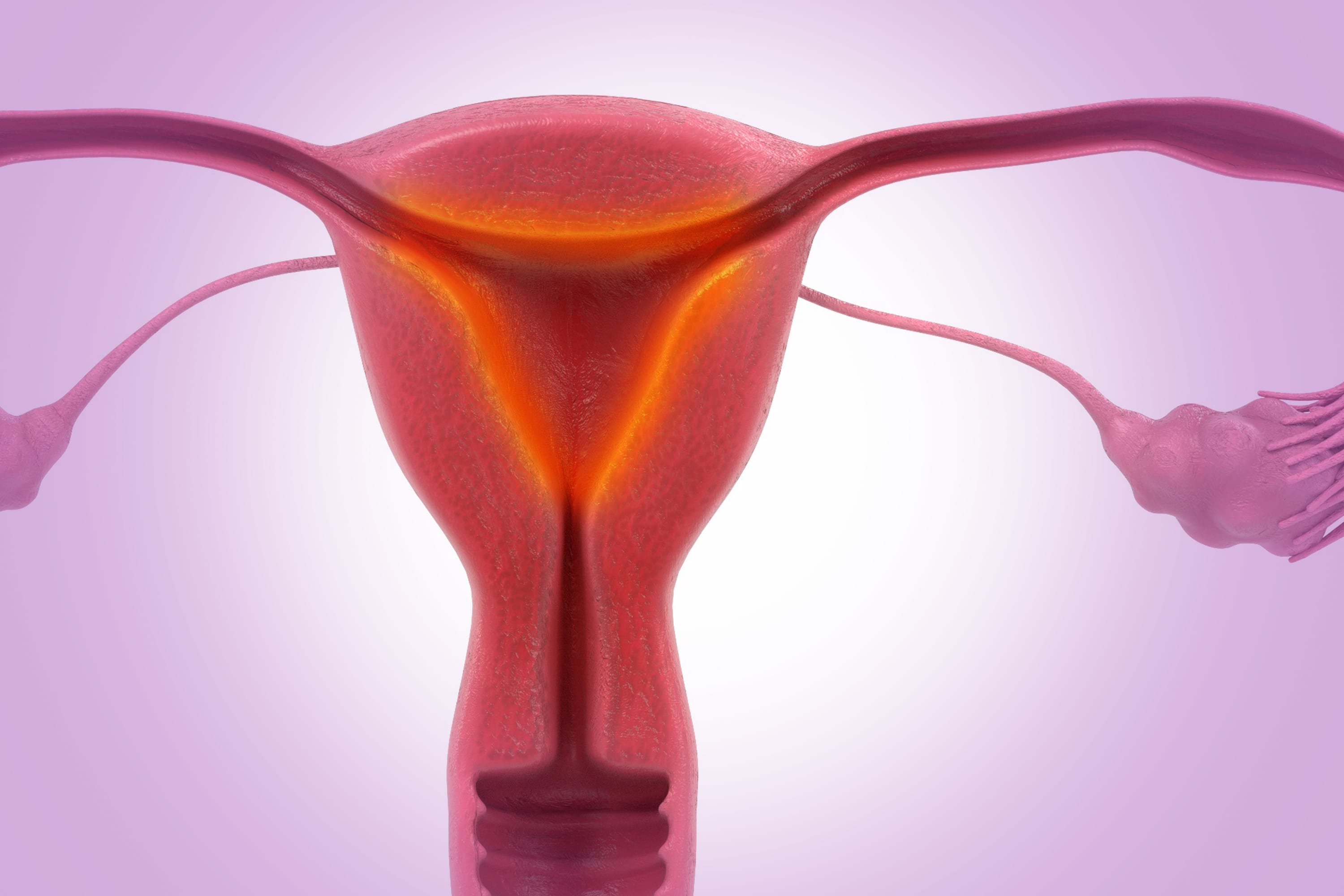 Endometrite: como é feito o tratamento