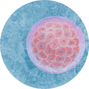 A transferência de embriões congelados minimiza os efeitos provocados na receptividade endometrial pelos hormônios utilizados na estimulação ovariana, aumentando as chances de a implantação ser bem-sucedida.