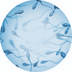 O que provoca a azoospermia não obstrutiva