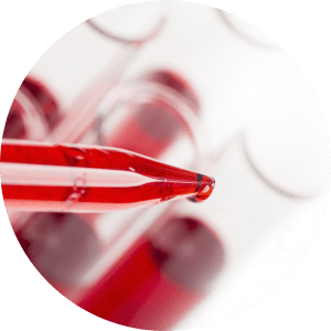 Como a trombofilia é diagnosticada