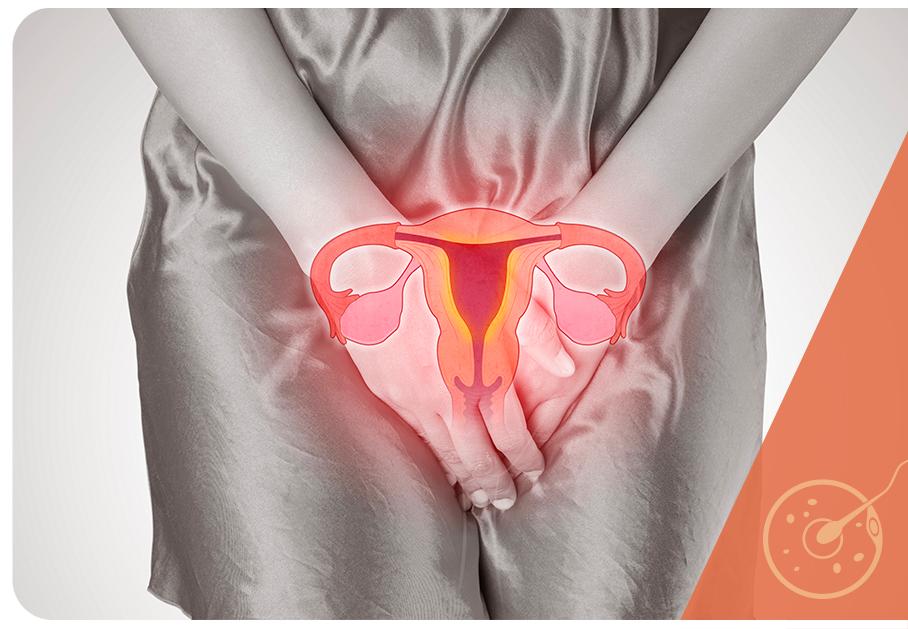 Endometriose e menstruação