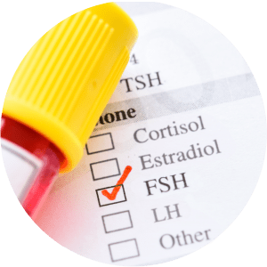 Dosagem sérica de FSH (hormônio folículo estimulante):