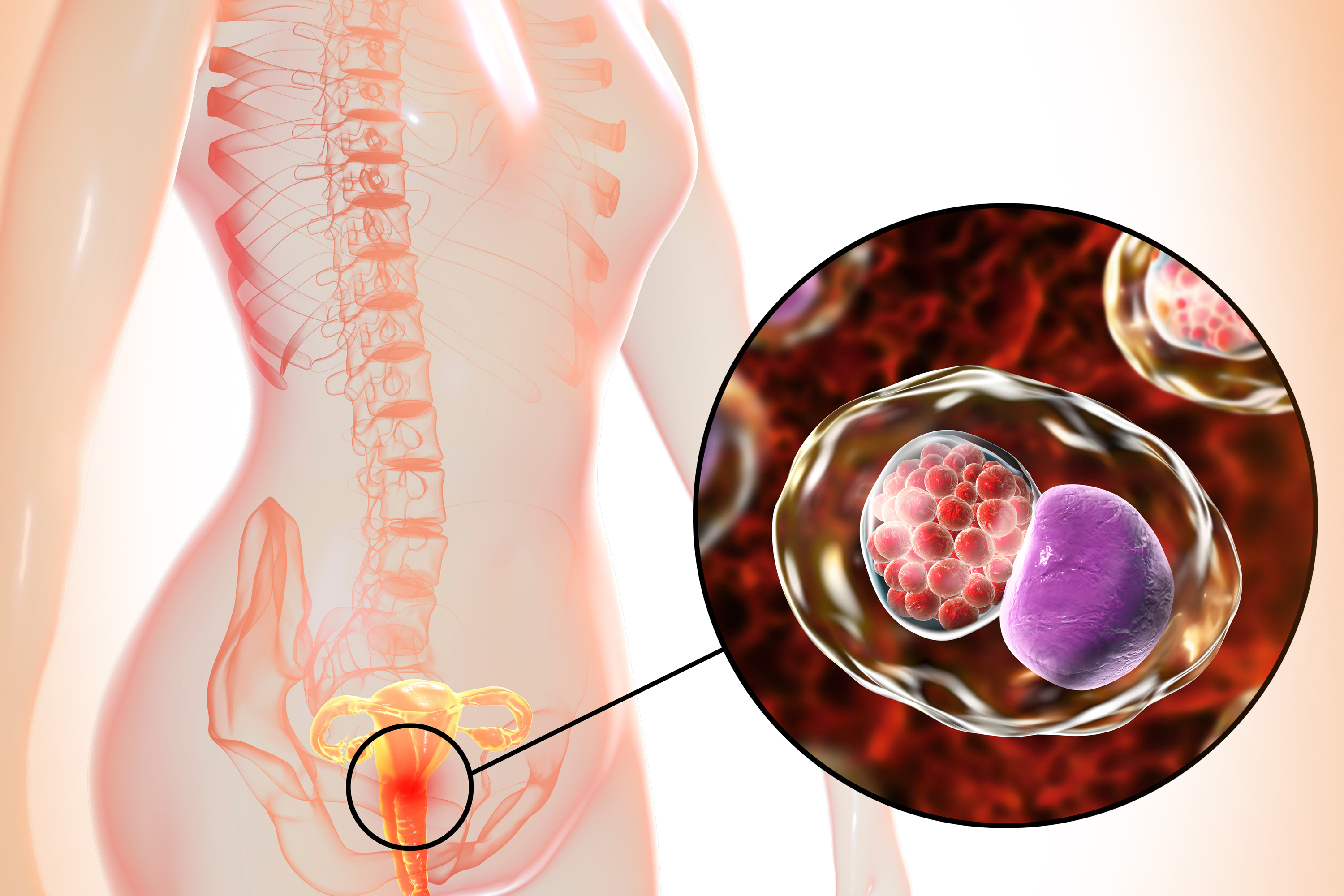 Quero um Bebê - SINTOMAS DE INFLAMAÇÃO NOS OVÁRIOS: A