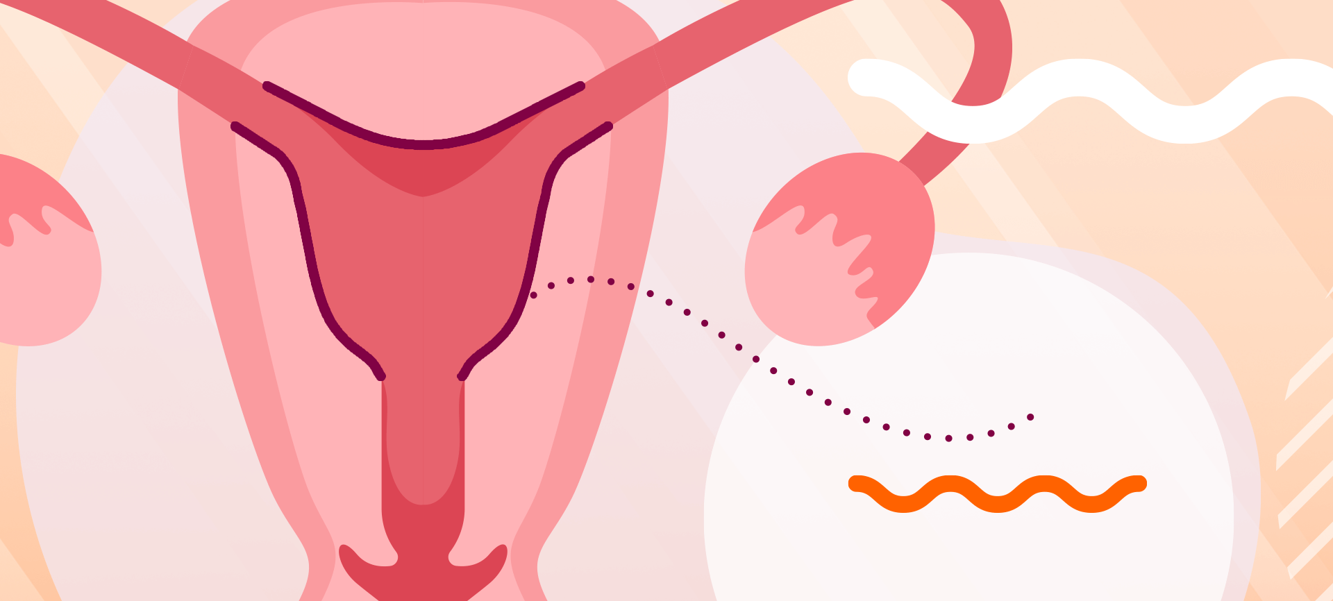 Preparo endometrial: como é feito na FIV?