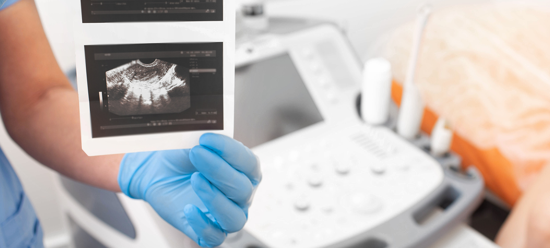 Ultrassonografia na investigação da infertilidade