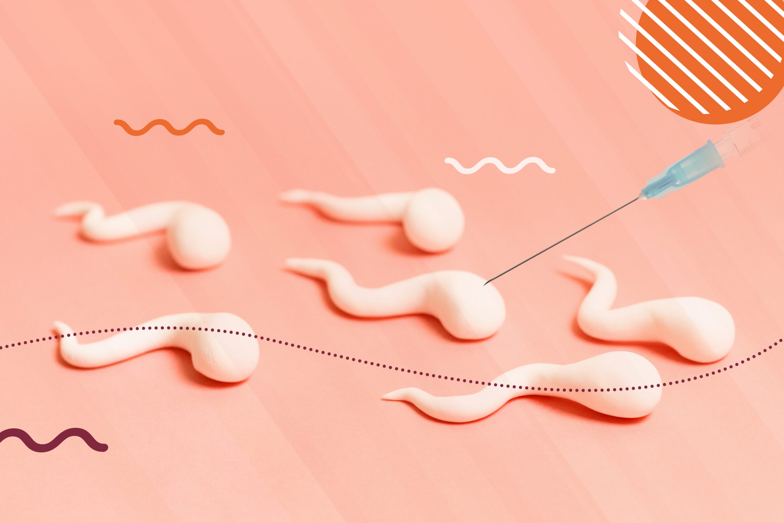 PESA e MESA: saiba mais sobre a recuperação espermática na FIV