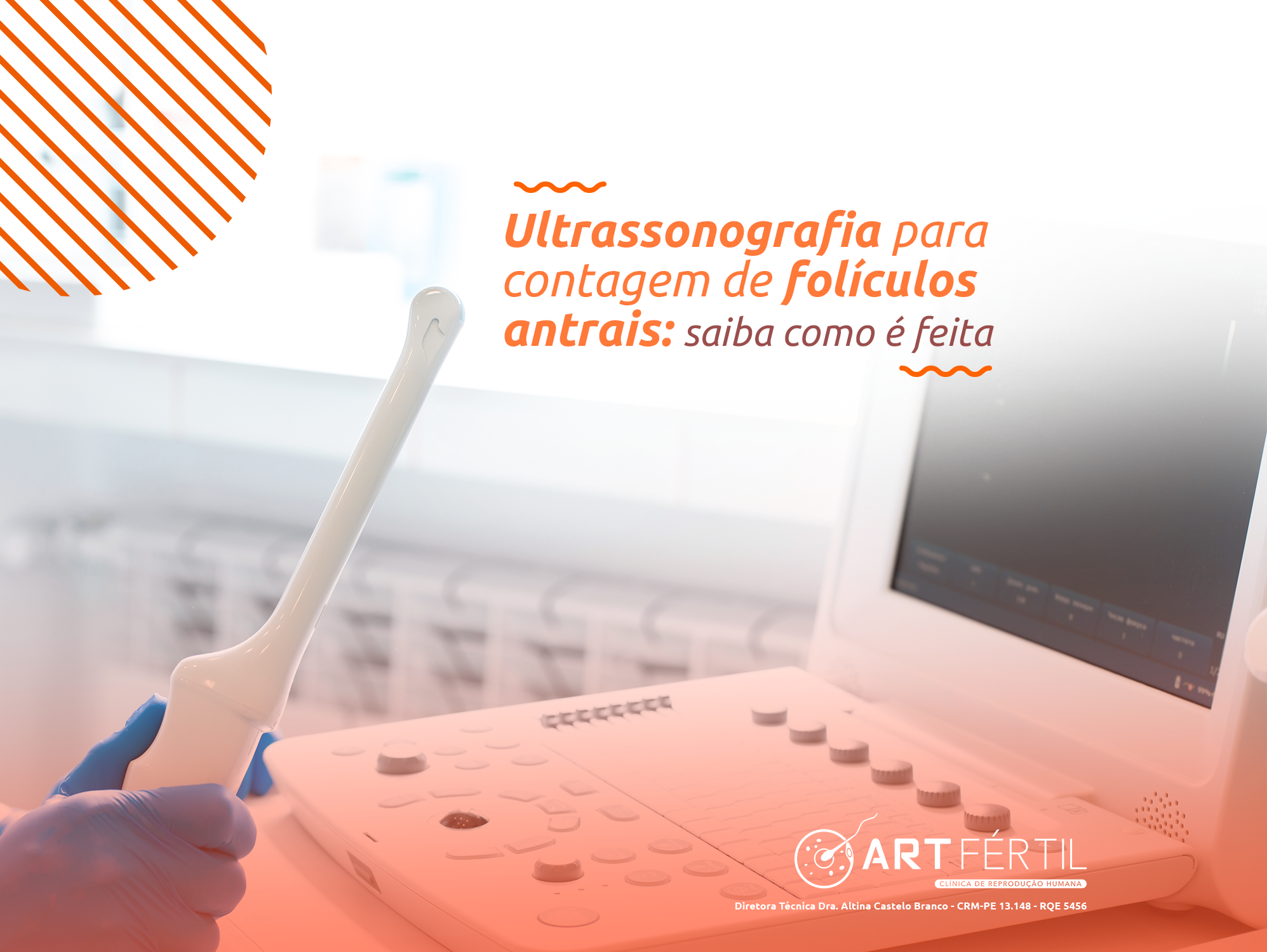 Ultrassonografia para contagem de folículos antrais: saiba como é feita