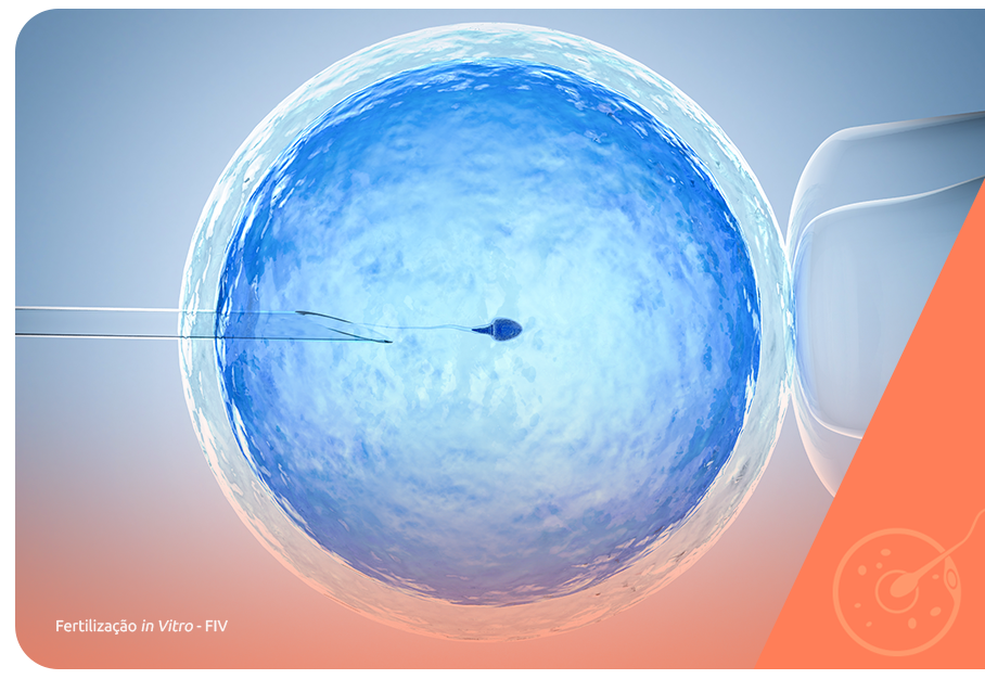 Videolaparoscopia e infertilidade - Art Fértil