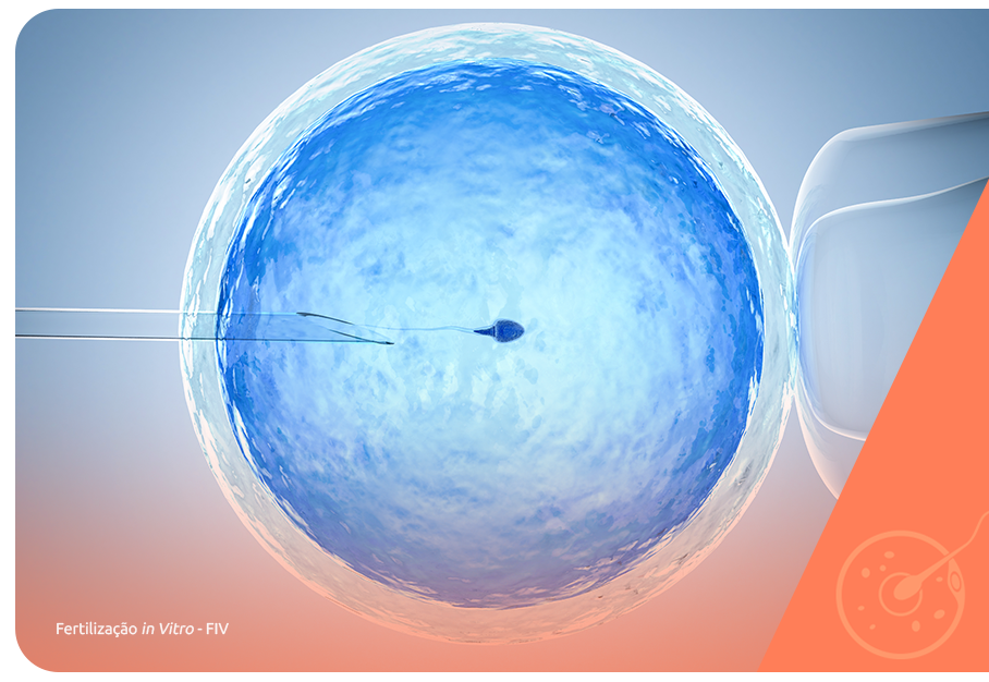 Endometriomas: o que são? - Art Fértil